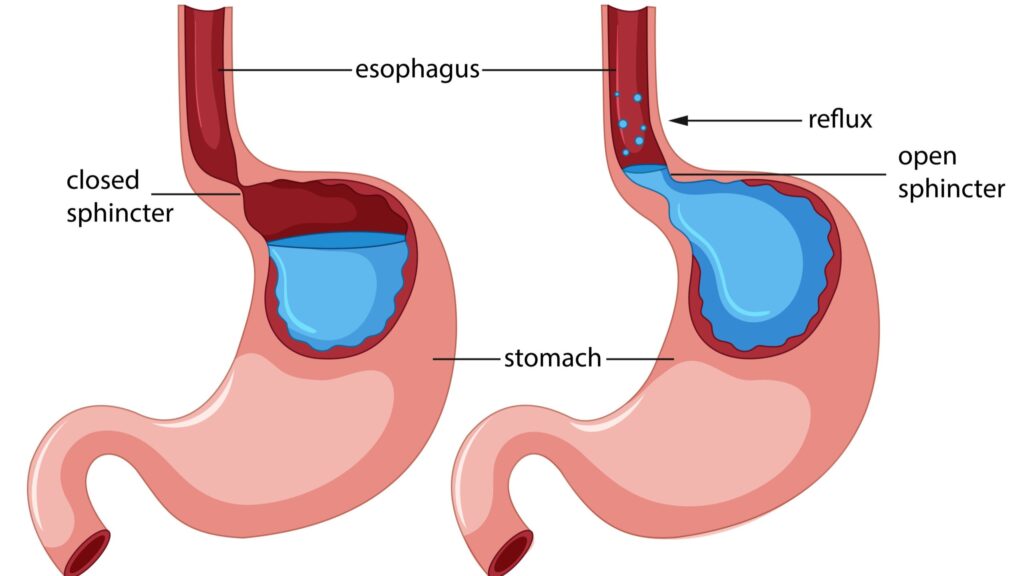 Liver Hospital in HSR Layout