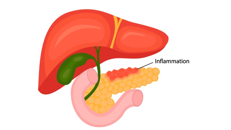 Liver Hospital in HSR Layout