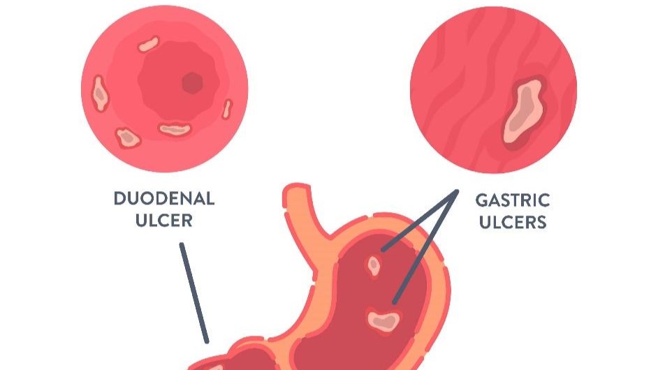 Liver Hospital in HSR Layout